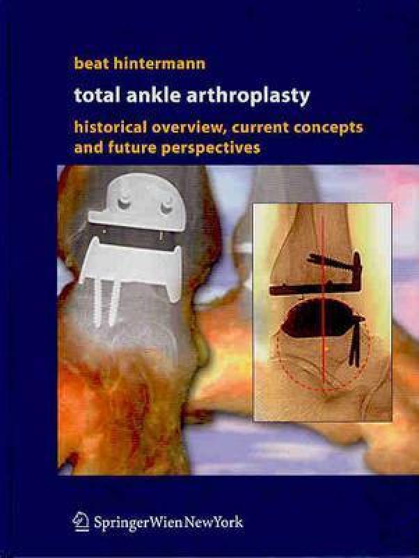 【预售】Total Ankle Arthroplasty: Historical Overview