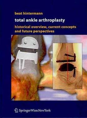 【预售】Total Ankle Arthroplasty: Historical Overview