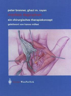 【预售】Morbus Dupuytren: Ein Chirurgisches Therapiekonzept