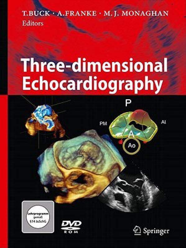 【预售】three-dimensional echocardiography [with dvd rom]