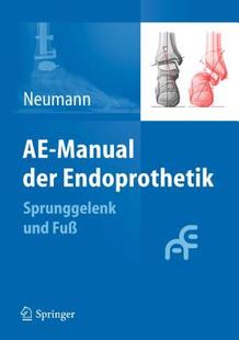 Manual Der Endoprothetik Und Sprunggelenk Fuss 预售