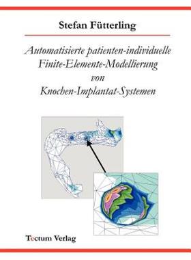 【预售】Automatisierte Patienten-Individuelle