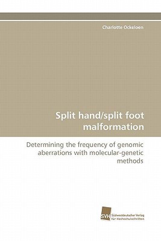 【预售】split hand/split foot malformation