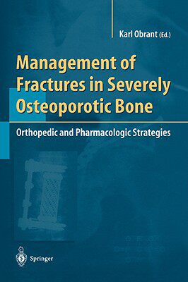 【预售】Management of Fractures in Severely Osteoporotic