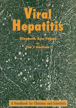 【预售】Viral Hepatitis