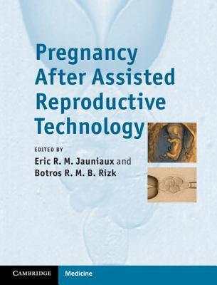 【预售】Pregnancy After Assisted Reproductive Technology