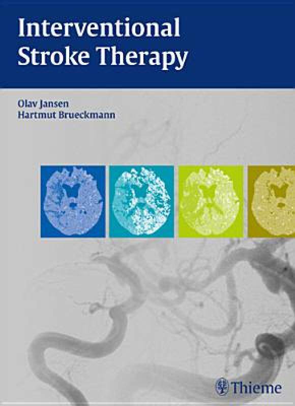 【预售】Interventional Stroke Therapy