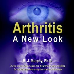 【预售】Arthritis-A New Look: Arthritic Indicators as Seen