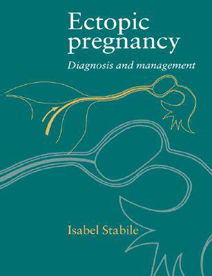 【预售】Ectopic Pregnancy: Diagnosis and Management