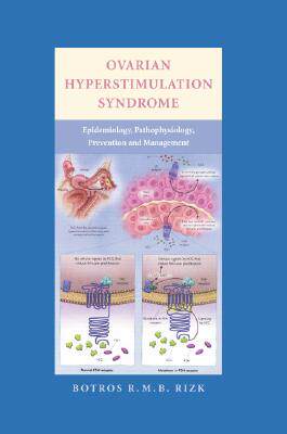 【预售】Ovarian Hyperstimulation Syndrome: Epidemiology