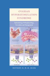 【预售】Ovarian Hyperstimulation Syndrome: Epidemiology