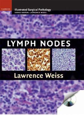 【预售】Lymph Nodes [With CDROM]