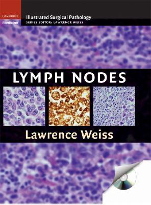 【预售】Lymph Nodes [With CDROM]