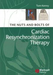 【预售】The Nuts And Bolts Of Cardiac Resynchronization
