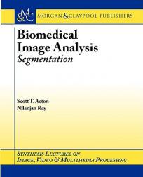 【预售】Biomedical Image Analysis: Segmentation