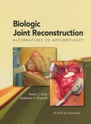 【预订】BIOLOGIC JOINT RECONSTRUCTION