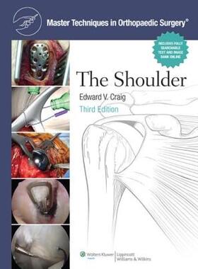 【预售】The Shoulder with Access Code