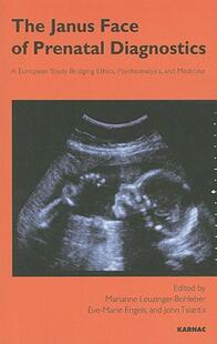 European Face Diagnosis Janus The 预售 Prenatal