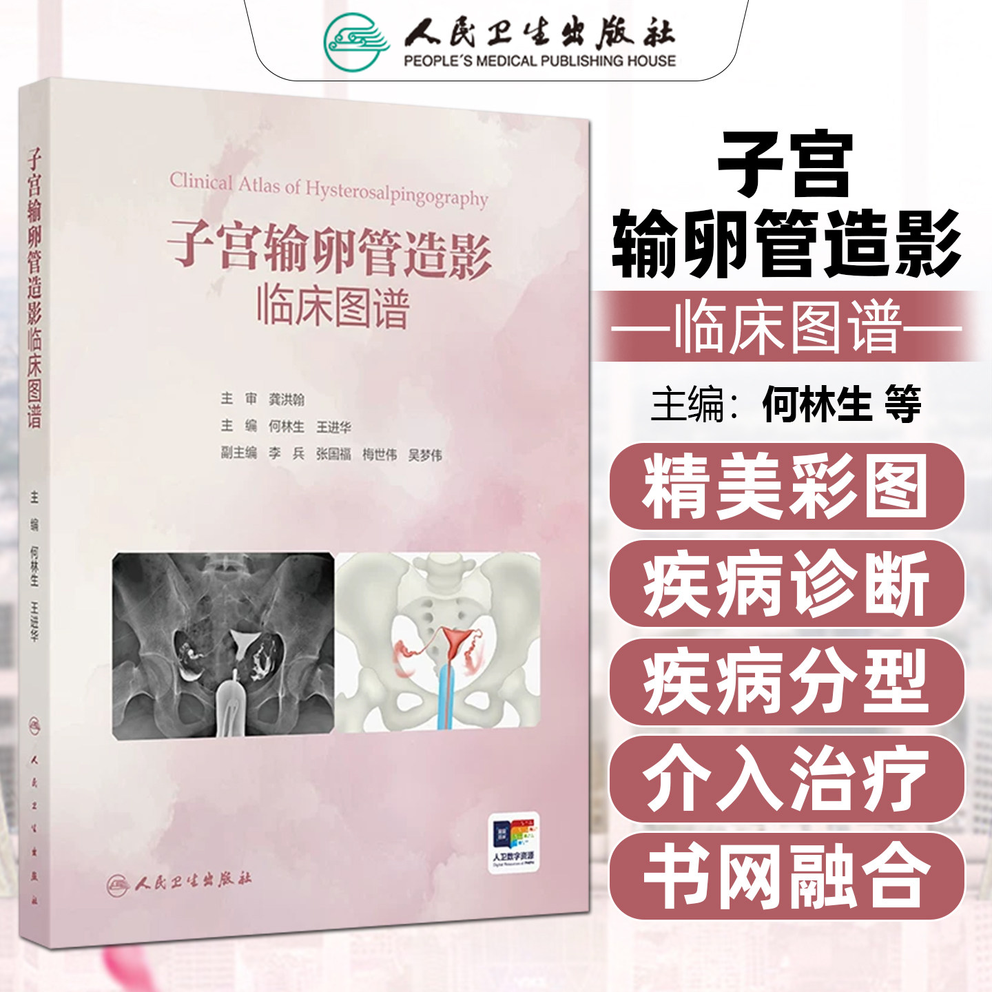 子宫输卵管造影临床图谱
