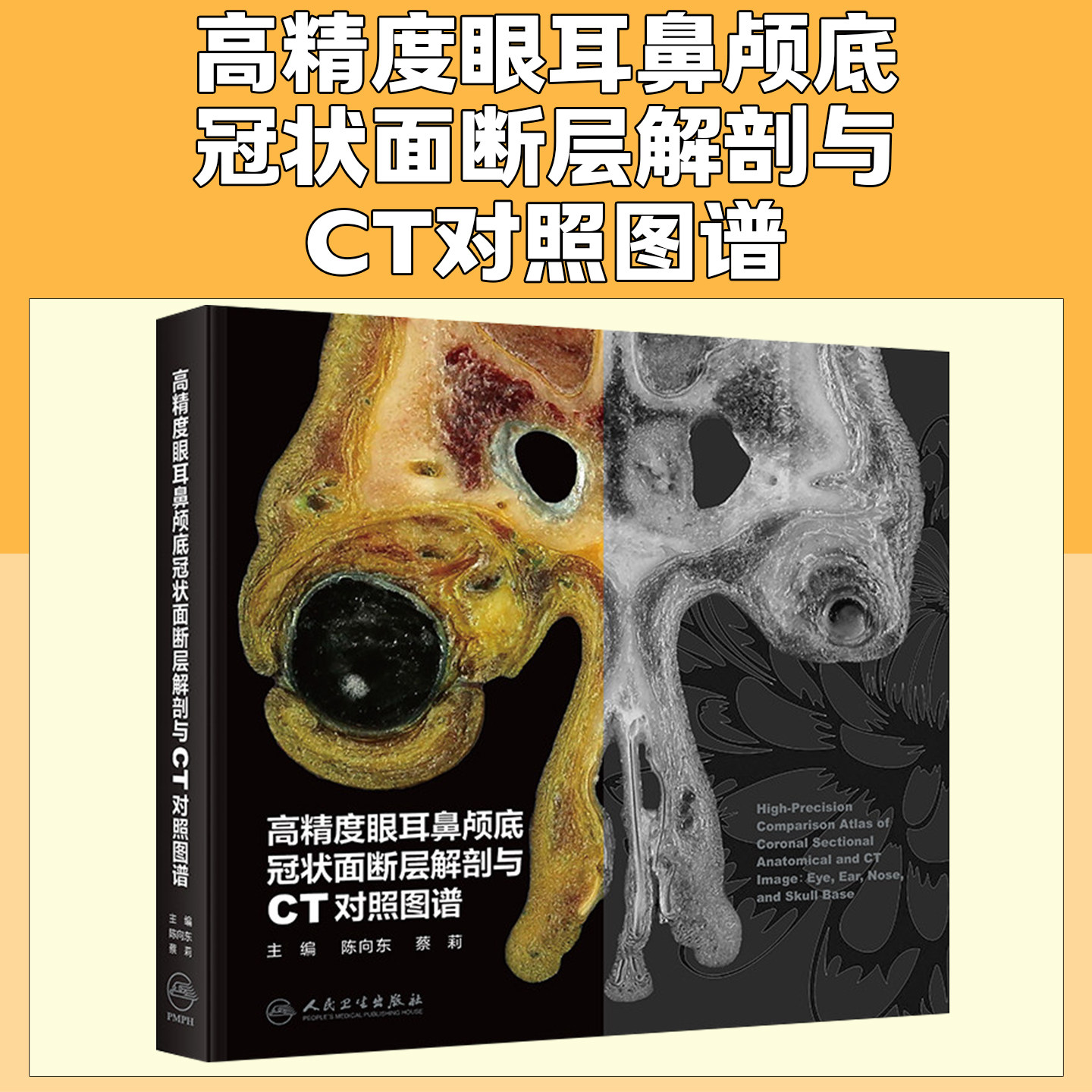 高精度眼耳鼻颅底冠状面断层解剖与CT对照图谱陈向东蔡莉人民卫生出版社9787117389396