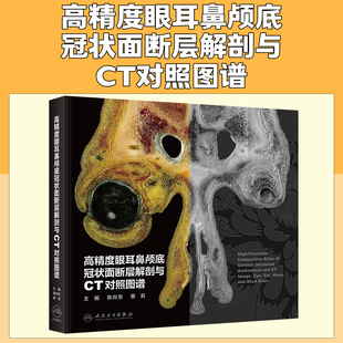 高精度眼耳鼻颅底冠状面断层解剖与CT对照图谱陈向东蔡莉人民卫生出版社9787117389396