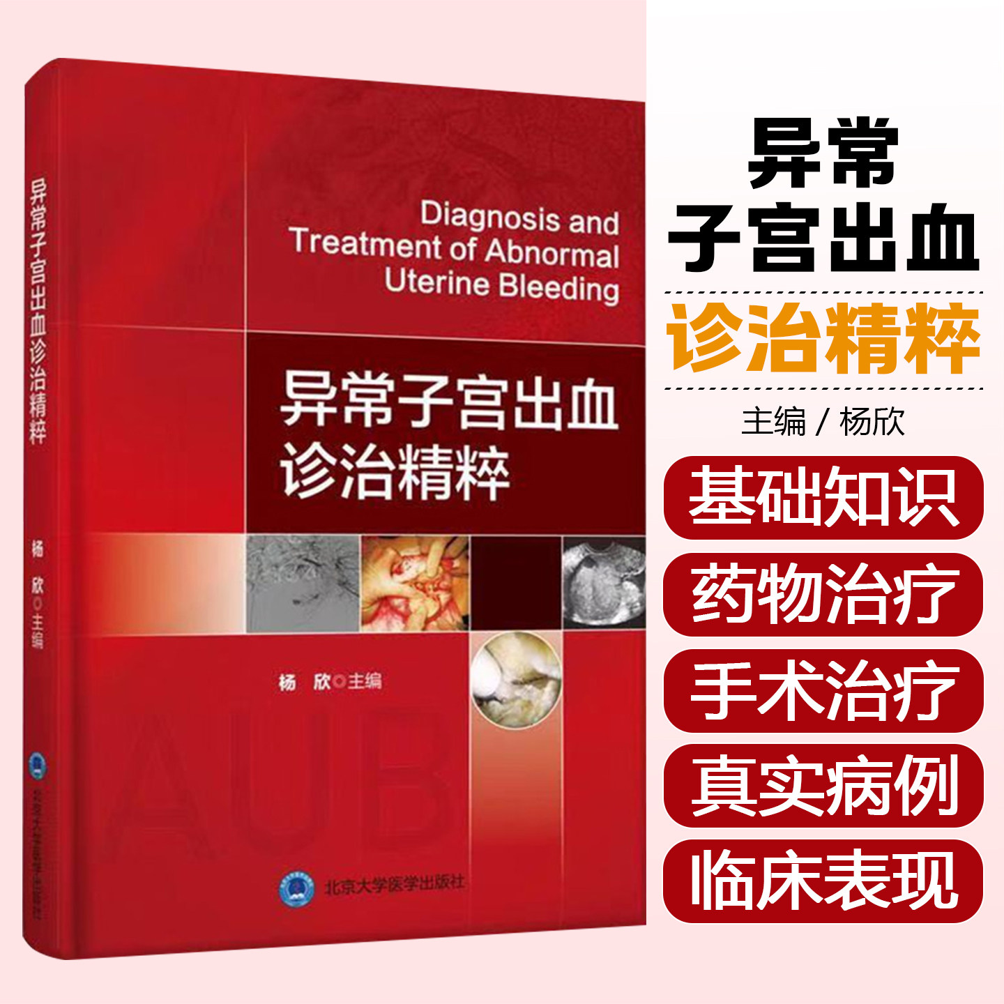 正版 异常子宫出血诊治精粹 主编杨欣 女性附件盆腔疾病大出血孕产期妇产科参考书籍  9787565920523 北京大学医学出版社