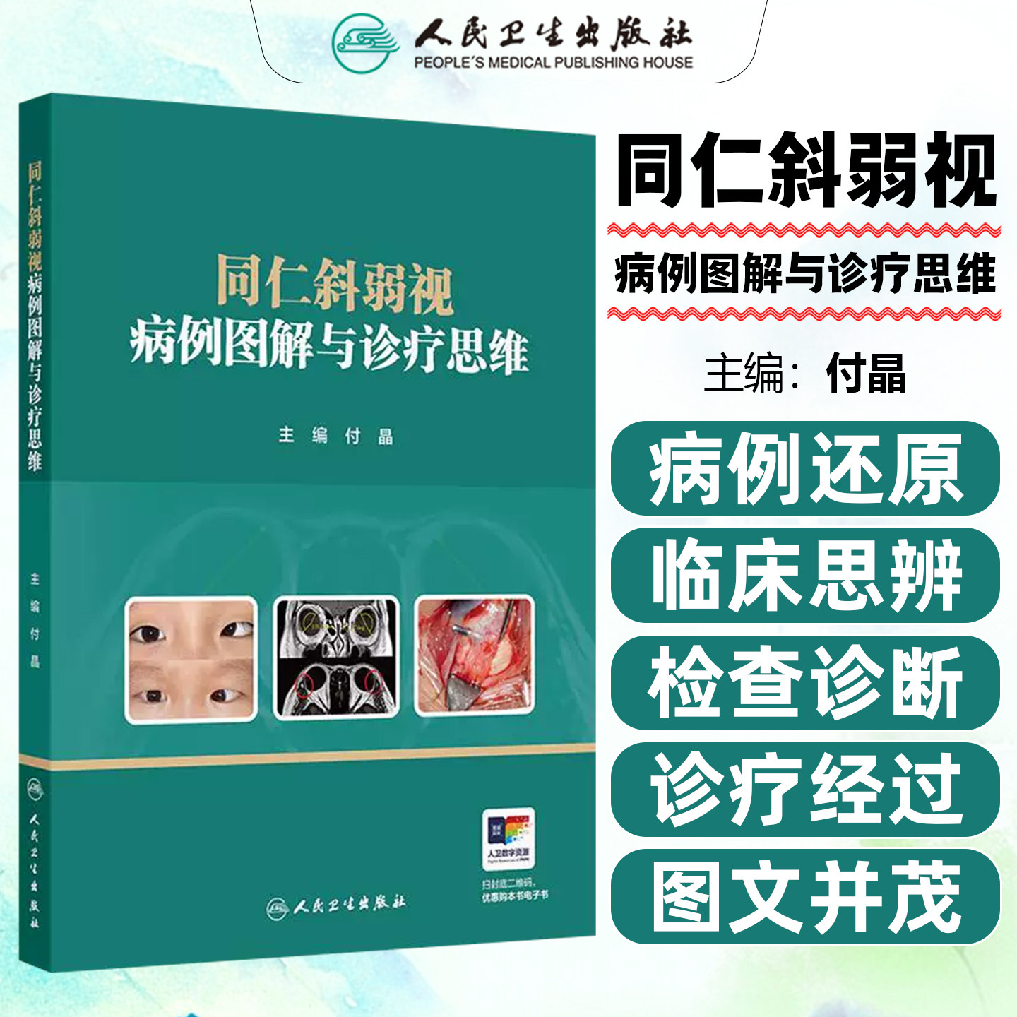 同仁斜弱视病例图解与诊疗思维付晶诊断治疗斜视弱视儿童屈光不正先天小儿眼科视功能康复近视防控人民卫生出版社