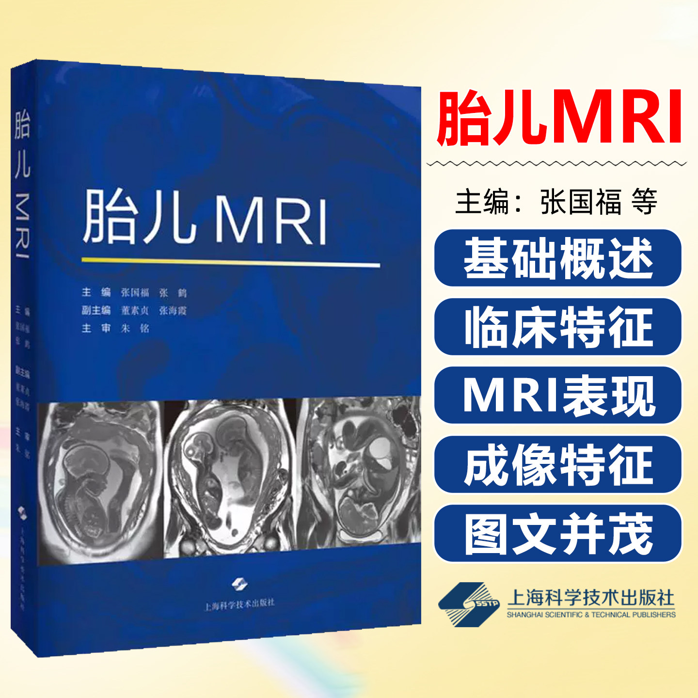 胎儿MRI 张国福 张鹤 对从事胎儿磁共振的影像科医师和新生儿医师产科医师都有帮助上海科学技术出版社