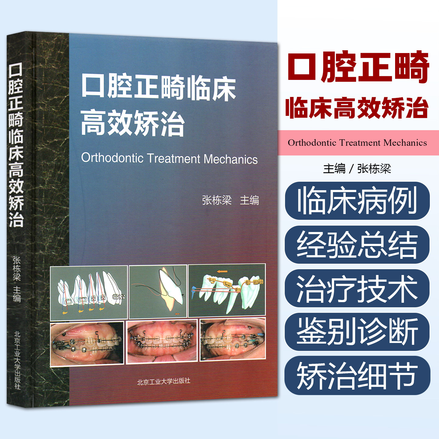 正版 口腔正畸临床高效矫治 张栋梁 口腔正畸学书籍口腔正畸专科教程口腔正畸临床治疗设计正畸材料 口腔书籍  北京工业大学出版社