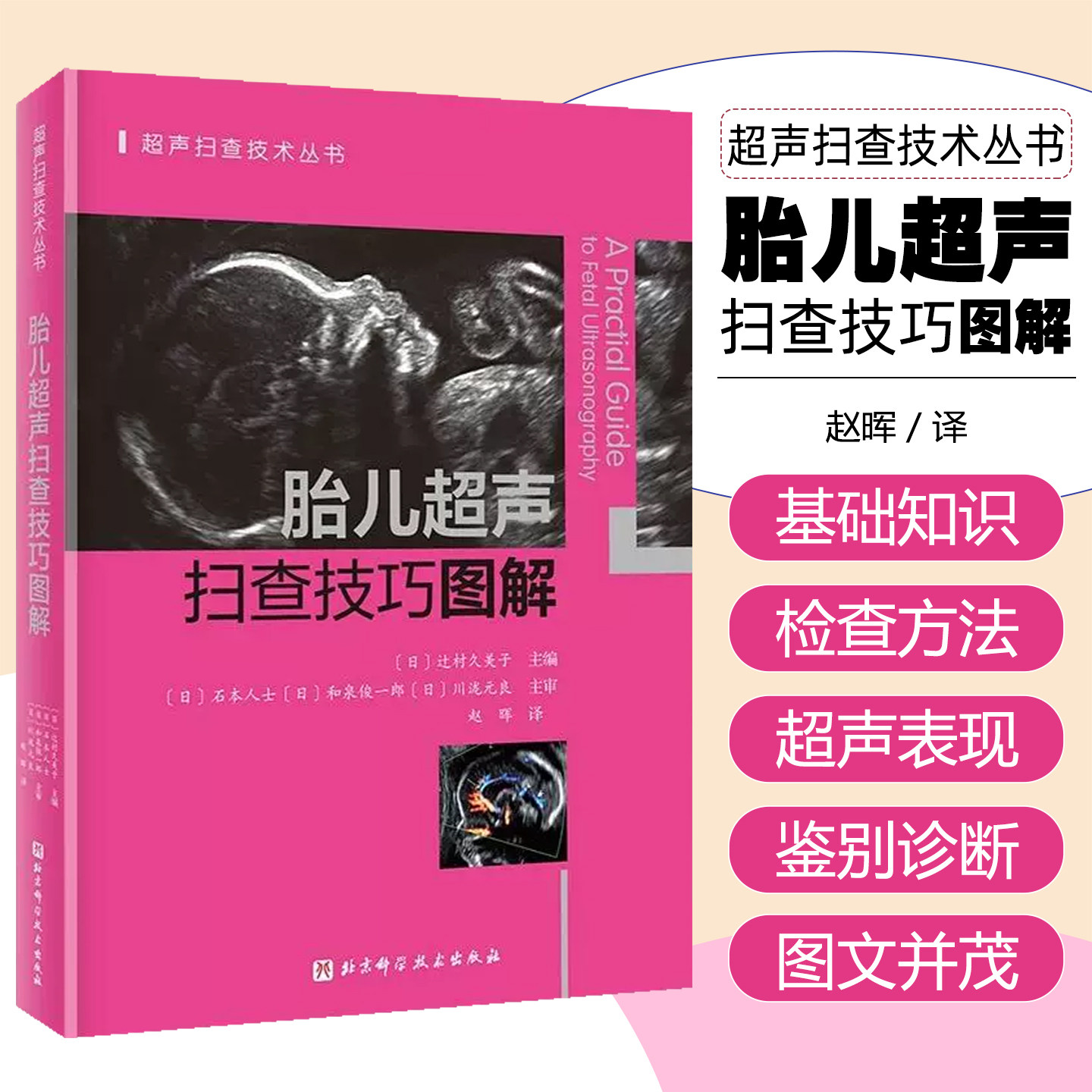 胎儿超声扫查技巧图解 北京科学技术出版社9787571442941