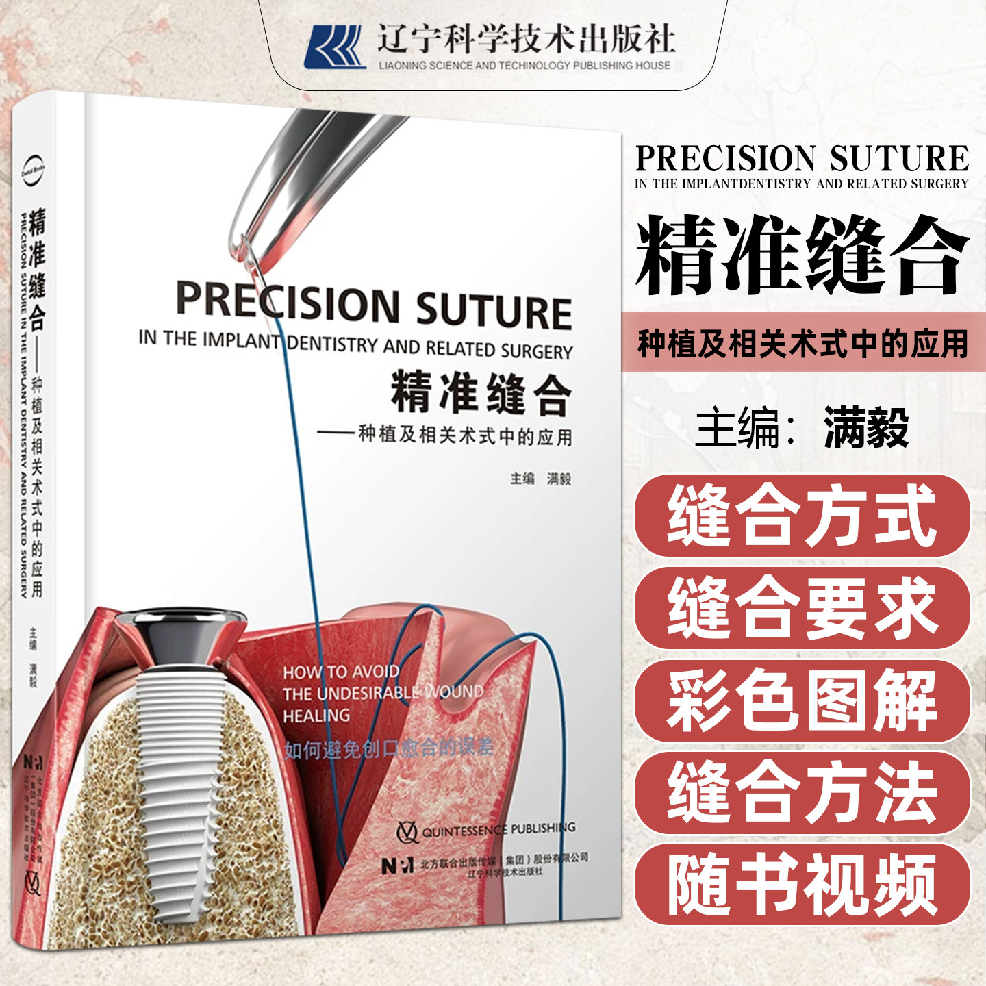正版精准缝合种植相关术式应用