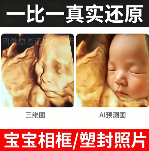 宝宝四维彩超相框定制还原A1精修纪念7寸相框