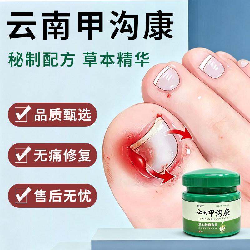 云南甲沟康修复趾指甲去息肉嵌甲甲板增厚指甲发黄空甲萎缩