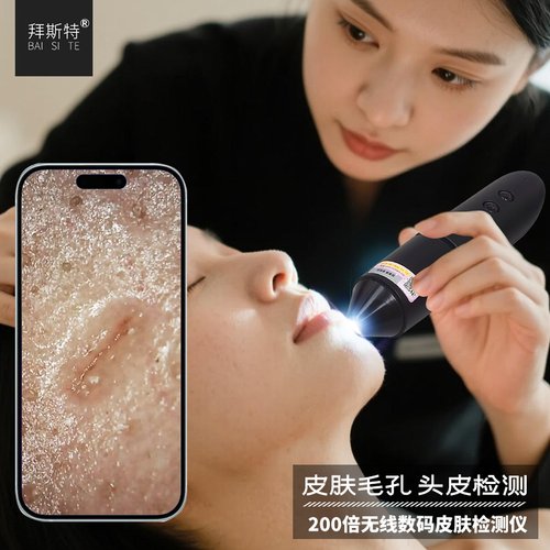 拜斯特放大镜皮肤检测仪看毛囊