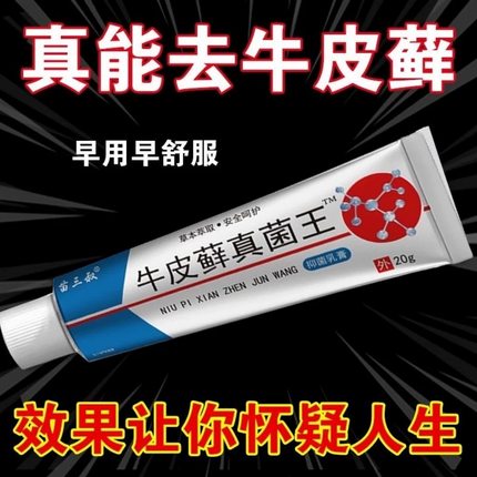 股藓大腿内侧根皮肤瘙痒真菌感染牛皮癣银屑药体股癣去湿疹止痒膏