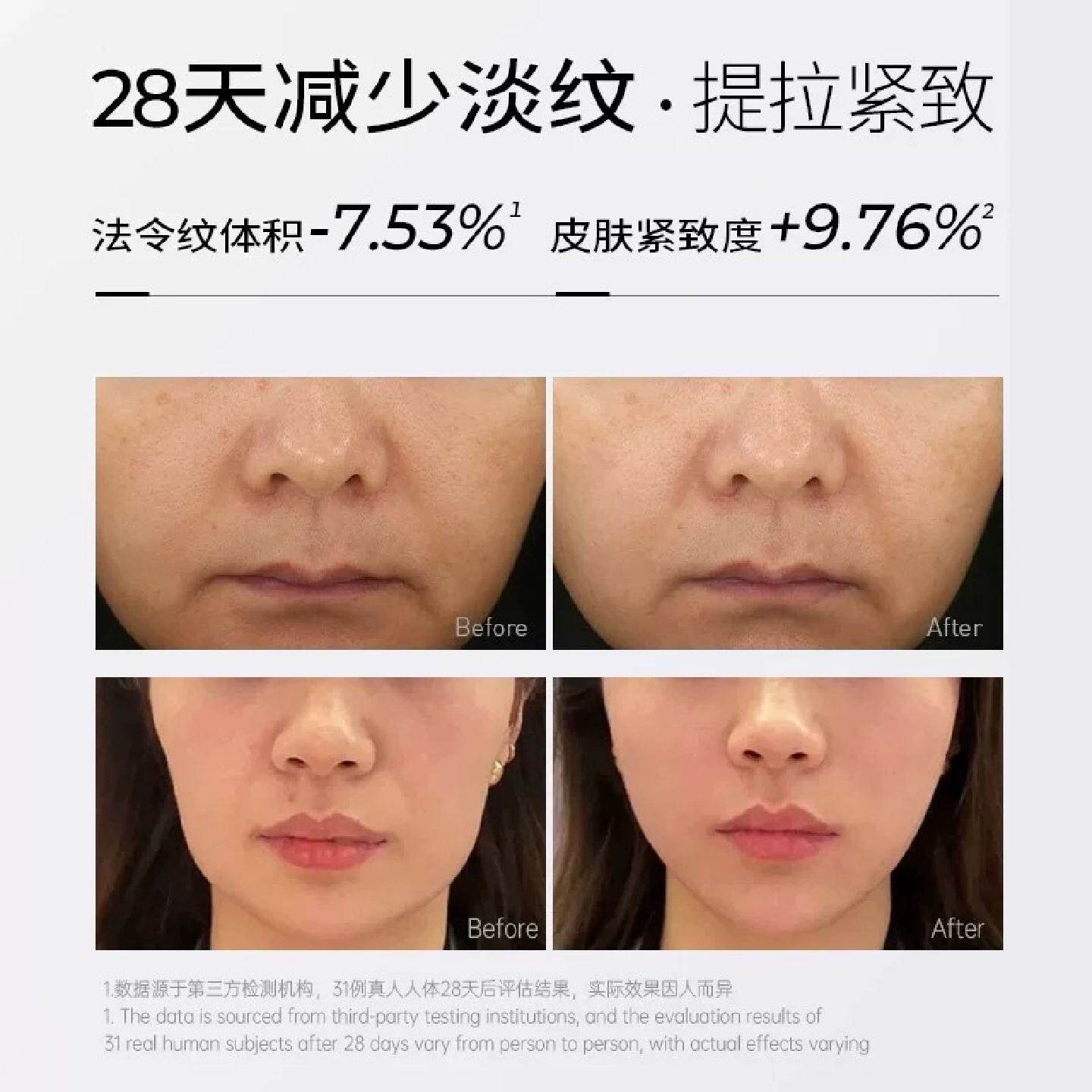 曼品质瘦脸神器绷带塑脸去法令纹睡眠面雕面罩脸部v脸提升面部提