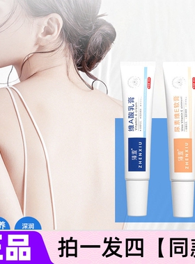 维生素维a酸乳膏和尿素霜维e乳酸软膏淡化黑色素沉淀乳胶膏