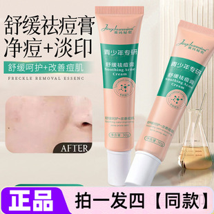 菁纯秘密壬二酸舒缓祛痘膏改善青少年青春痘油痘肌嫩肤净颜软膏