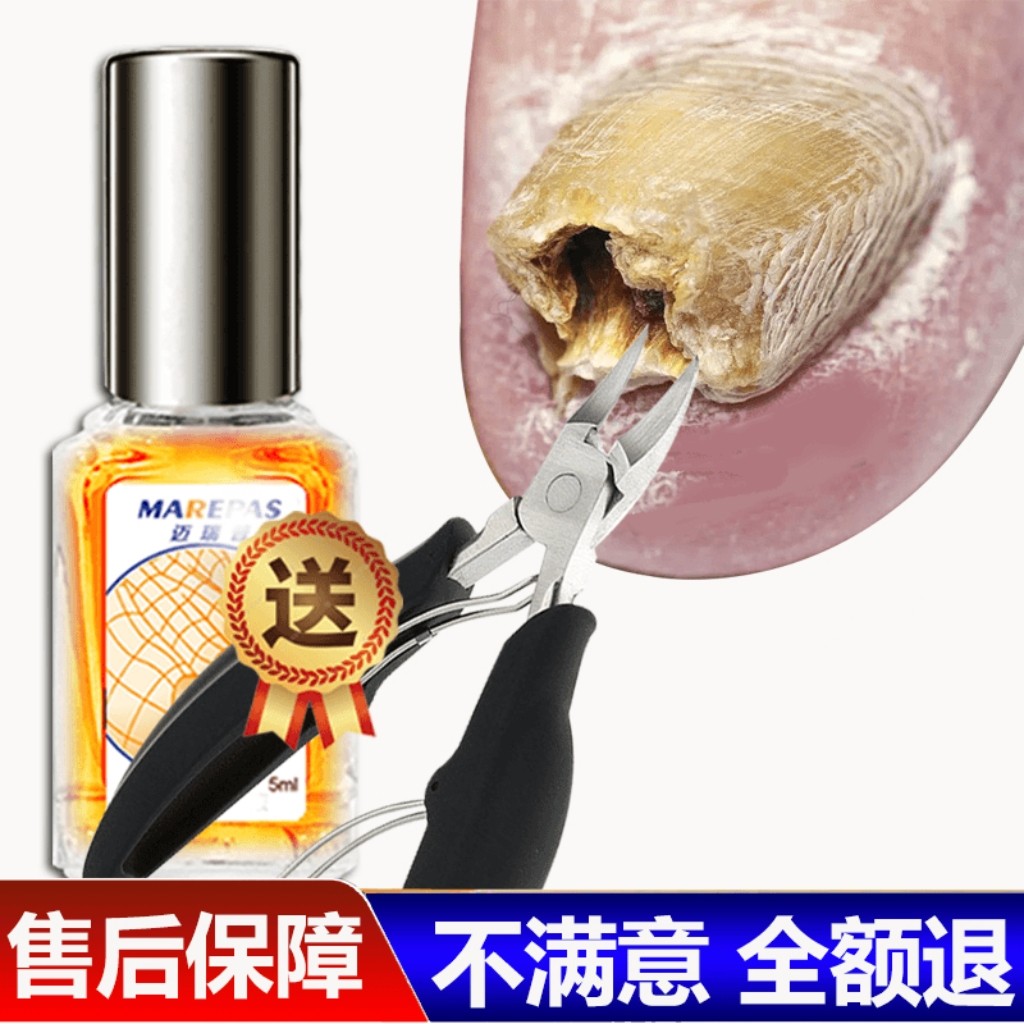 无痛脚趾手指甲增厚甲沟亮甲特效美甲液