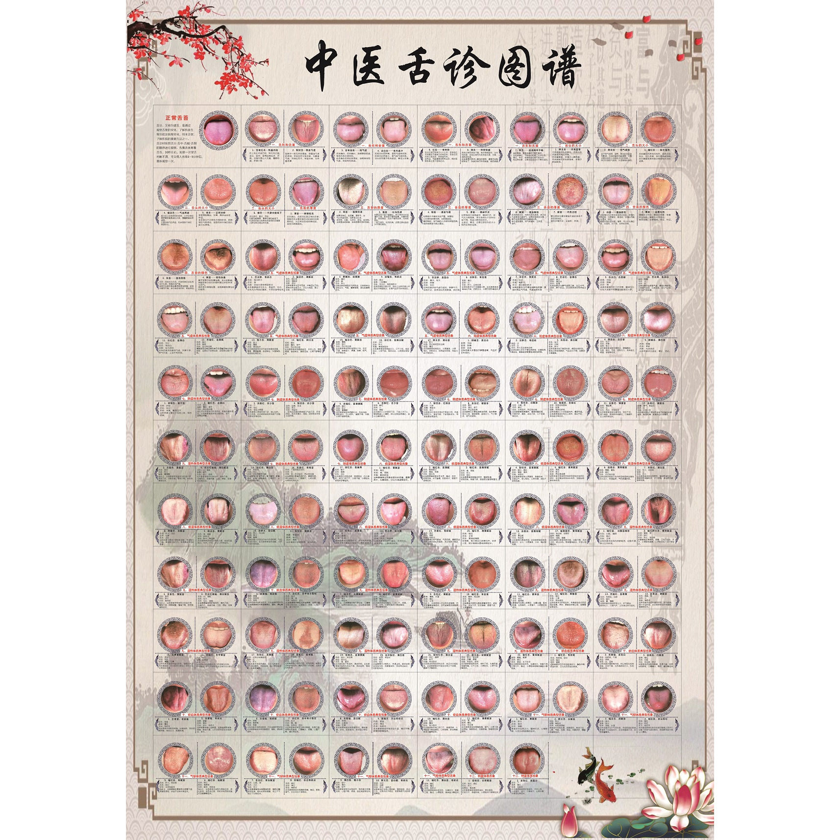 中医舌诊图谱大挂图70×100CM加厚相纸覆膜彩色高清文字大张海报