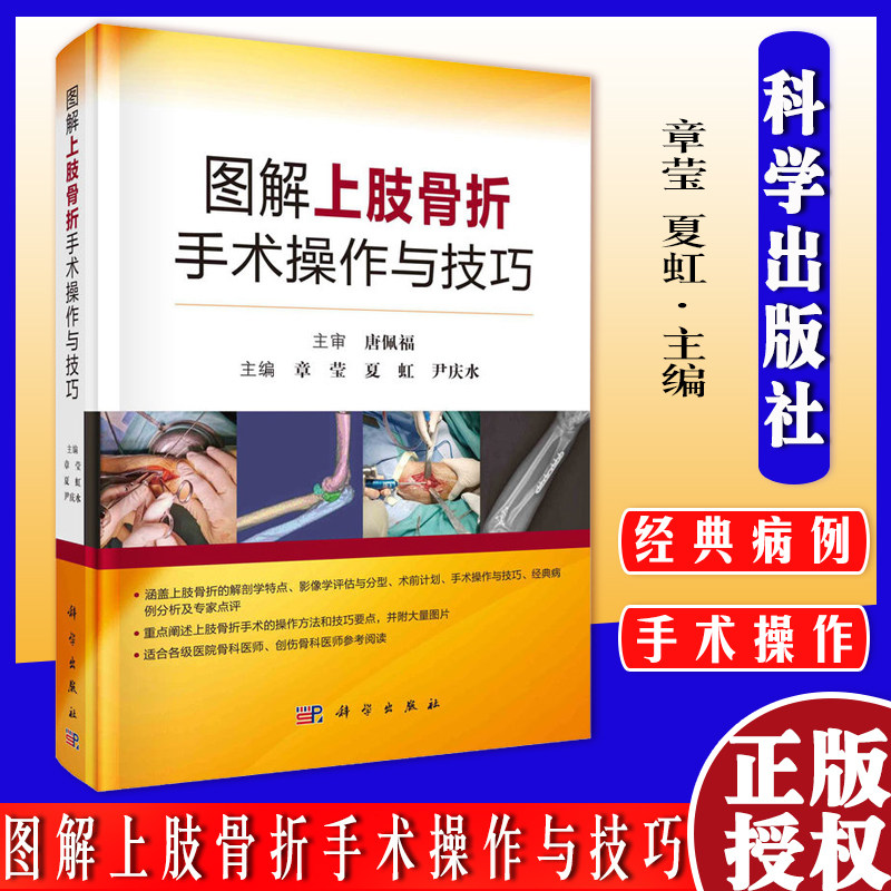 图解上肢骨折手术操作与技巧 章莹 夏虹 尹庆水 主编 锁骨骨折与肩锁关节脱位 手术操作与技巧 科学出版社 9787030712721