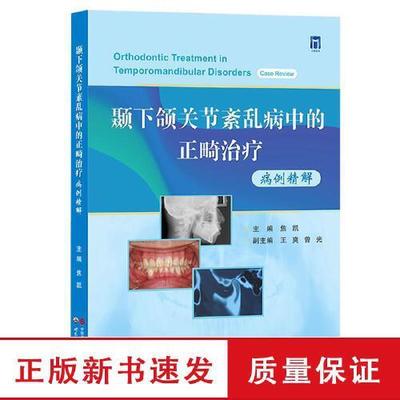 颞下颌关节紊乱病中的正畸治疗病例精解 焦凯主编 颞下颌关节正畸病案分析TMDs患者多元化分级诊疗口腔正畸医学书世界图书出版