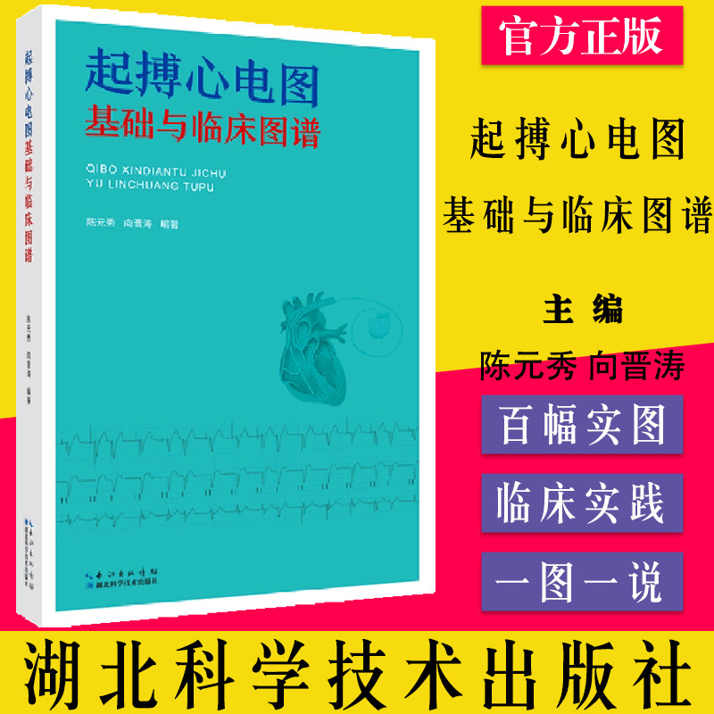 起搏心电图基础与临床图谱陈元秀 向晋涛 起搏器负性频率滞后作用同步心房汽博基础 按需心室起搏湖北科学技术出版社9787570601523