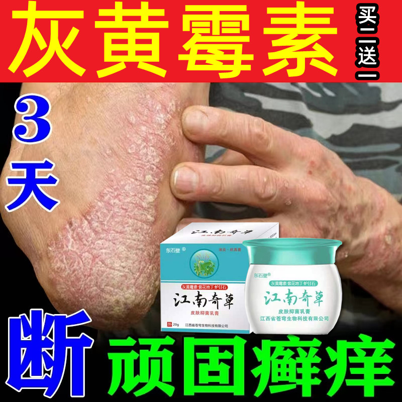 灰黄霉素软膏真菌感染灰黄霉素外用药膏辉煌霉素软膏头癣治头癣药