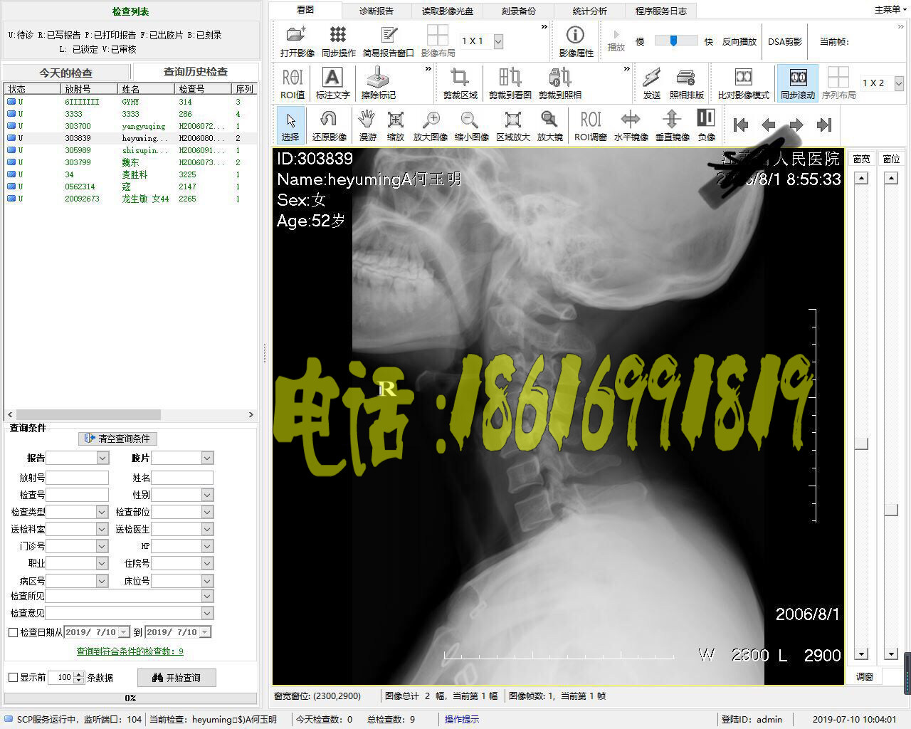 DR软件DR工作站软件CR软件X光机核磁工作站软件DSA软件PACS系统