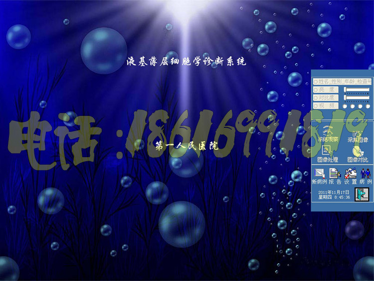 TCT液基薄层细胞检测软件TCT检测检测TCT液基细胞随心所欲XP/win7