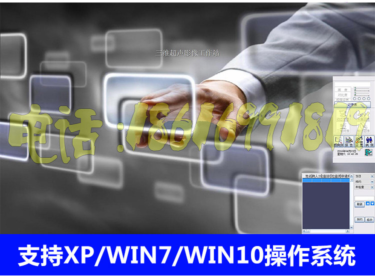 超声随心所欲XP版B超声软彩超软件支持XP、WIN7、Win10系统