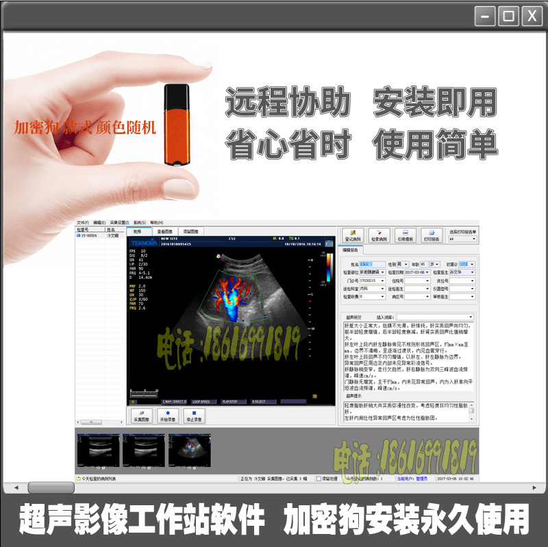 超声工作站软件超声影像软件B超软件彩超软件加密锁win10/win11版
