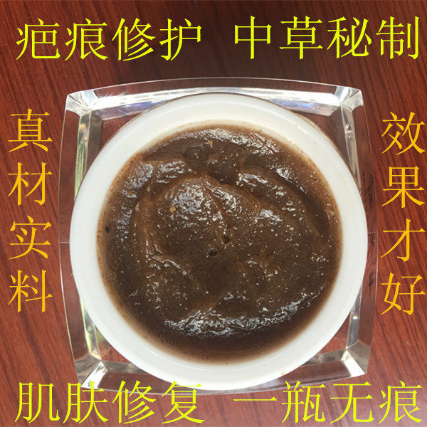 剖腹产疤痕灵修复膏擦伤摔伤去痘印痘坑烧烫伤增生手术凹凸疤痕