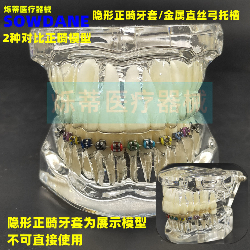 牙科牙模型隐形正畸模型医患沟通讲解教学模型正畸2种对比模型